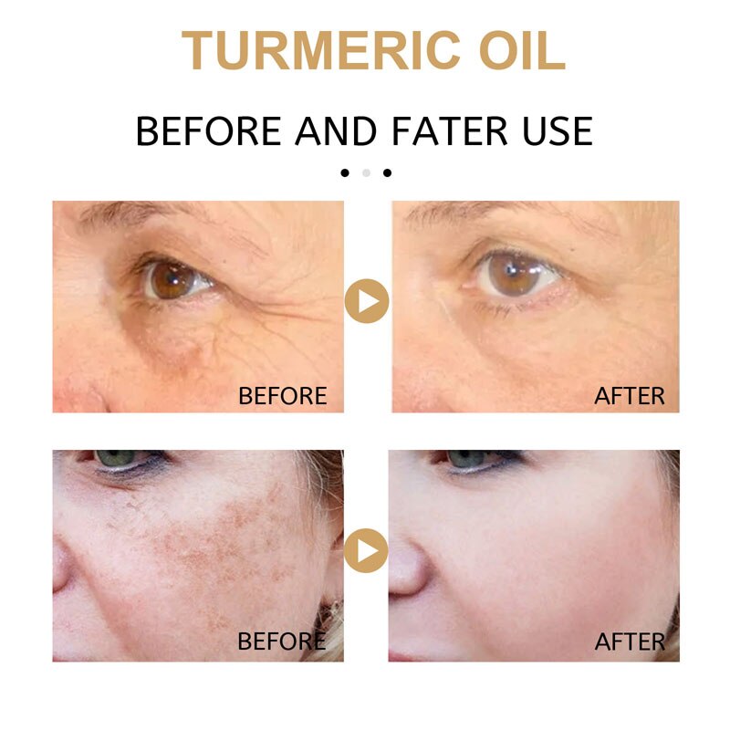 Turmeric Face Serum Lighten Spots Essential Oils Turmeric Oil Anti Aging Remove Dark Spots Pigmentation Corrector Skin Care 30ml