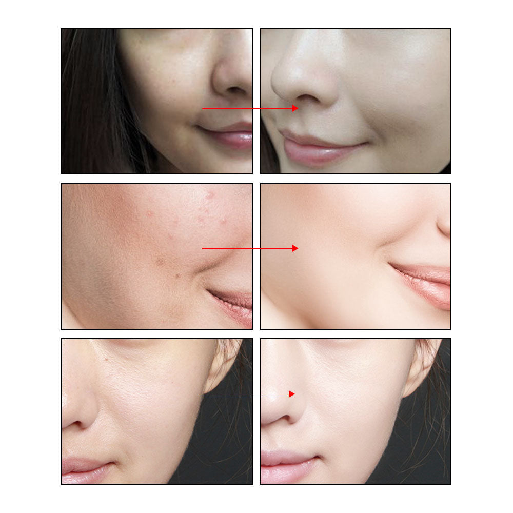 ARTISCARE Nicotinamide Serum 2pcs Facial Whitening Essence for Skin Care Anti Aging and Anti Wrinkle Face Cream Brightening