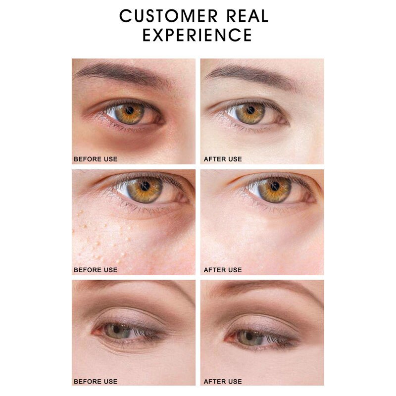 ARTISCARE Golden Eye Cream + Anti Wrinkles Eye Serum Roller Massager Anti Fine Lines Dark Circles Anti-Aging Eye Care