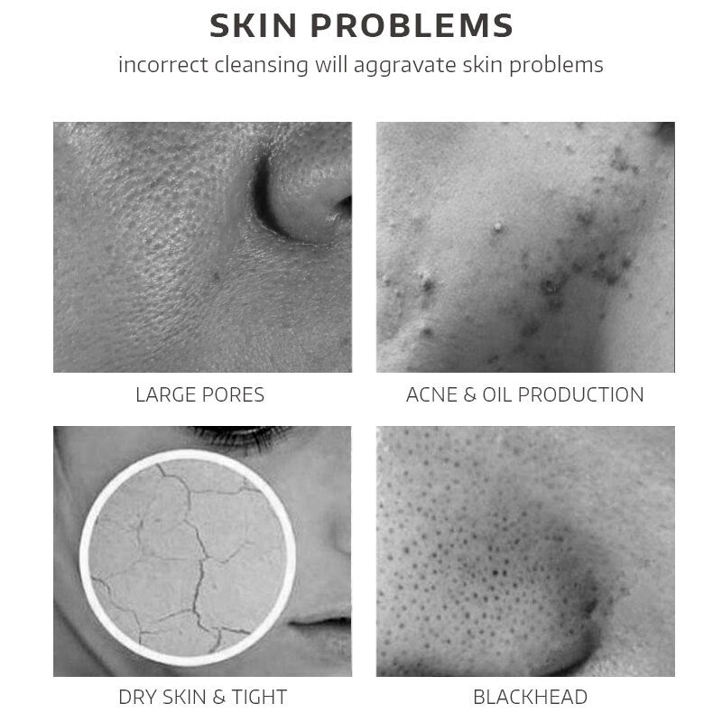 Facial Cleanser Foam Rose Cleansing Gel Face Wash Remove Blackhead Moisturizing Shrink Pores Deep Cleaning Oil Control Skin Care