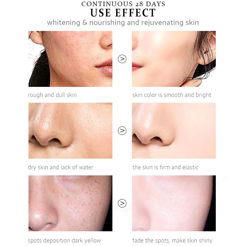 Whitening Face Cream for Removal Freckles and Dark Spots Skin Repair Whitening and Moisturizing Remove Sunburn Whitening Cream