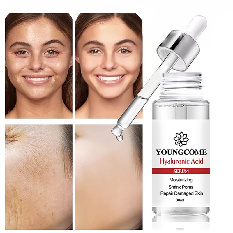 YOUNGCOME 30ML Hyaluronic Acid Essence Face Serum Anti-Aging Wrinkle Cream Lifting Firming Whitening Moisturizing Skin Care