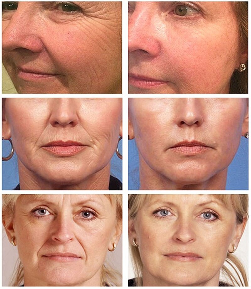 24K Gold Serum Anti Aging Remove Wrinkle Lifting Firming Face Essence Fade Fine Lines Whitening Moisturizing Skin Care Cosmetic