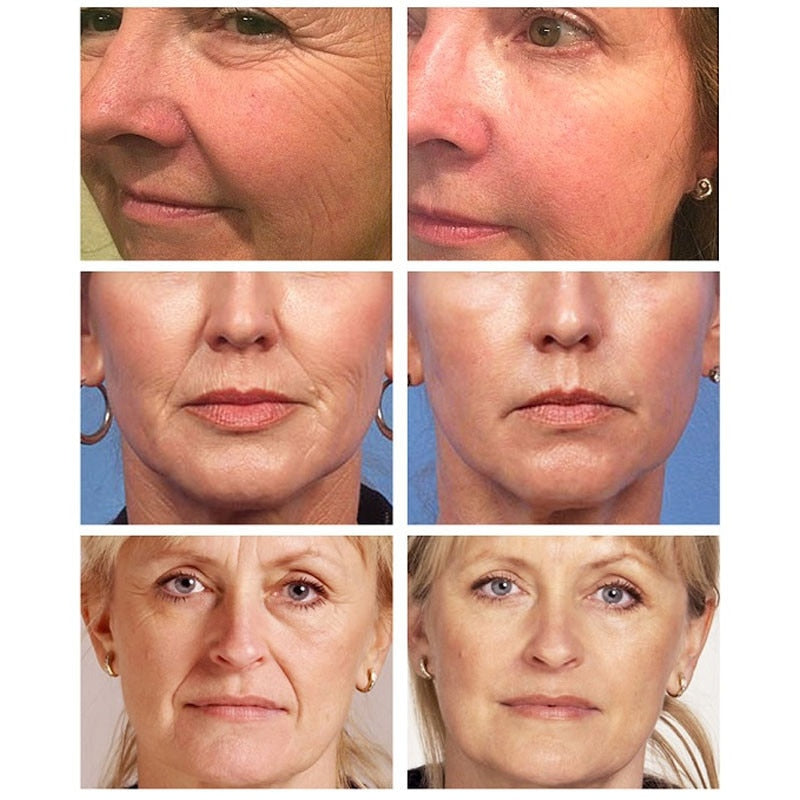 Collagen Removal Wrinkle Serum 24K Gold Anti Aging Lifting Firming Fade Fine Lines Face Essence Moisturizing Skin Care Products