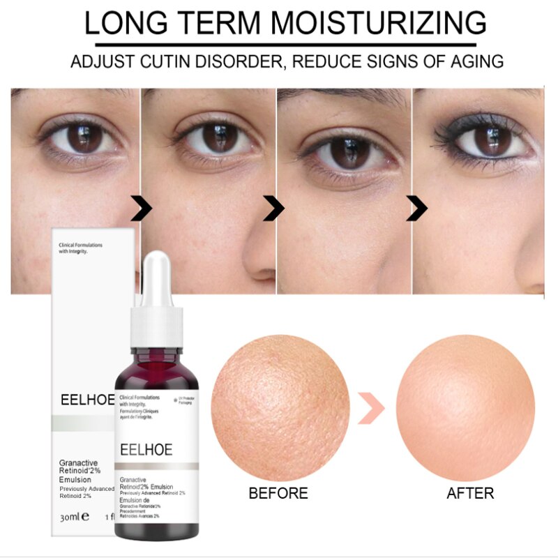 Shrink Pores Serum Salicylic Fruit Acid Essence Exfoliating Moisturizing Nourish Smooth Pore Repair Dry Skin Care Cosmetic 30ml