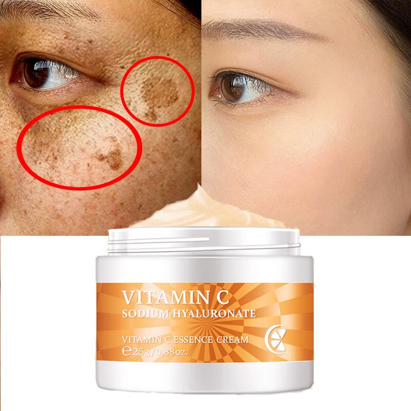 Vitamin C Whitening Freckle Serum Remove Melasma Acne Dark Spots Fade Pigment Melanin Corrector Moisturizing Brighten Skin Care