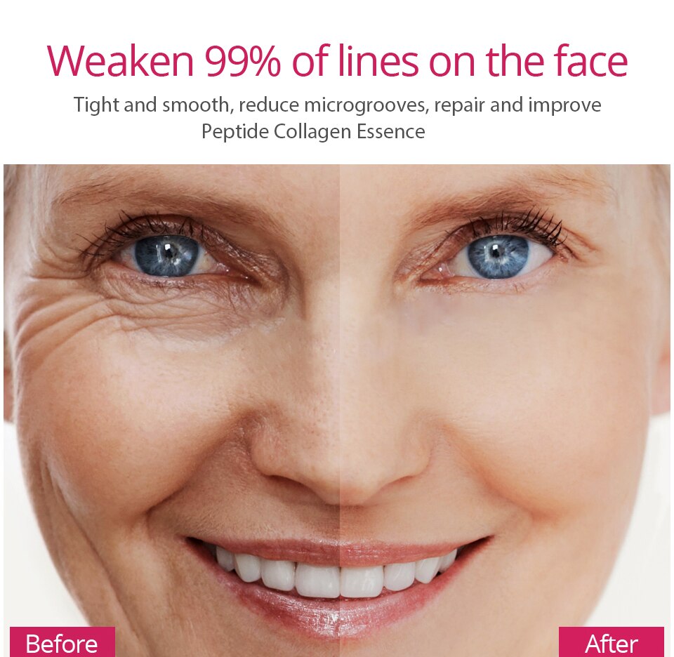YOUNGCOME 30ML Hyaluronic Acid Essence Face Serum Anti-Aging Wrinkle Cream Lifting Firming Whitening Moisturizing Skin Care