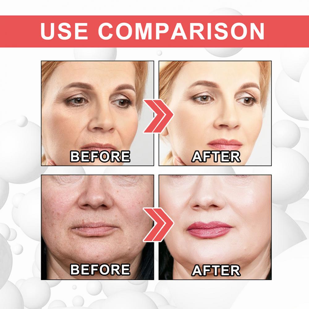 EELHOE Face Collagen Anti-Wrinkle Cream Anti Aging Dark Spot Remover For Face Serum Whitening Firming Cream Women Face Skin Care
