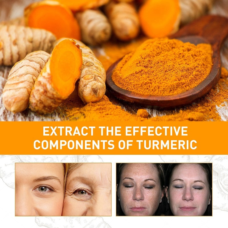 Turmeric Serum Whitening Freckle Dark Spots Organic Turmeric Oil Brighten Dark Skin Pigmentation Anti Aging Anti Wrinkle Essence