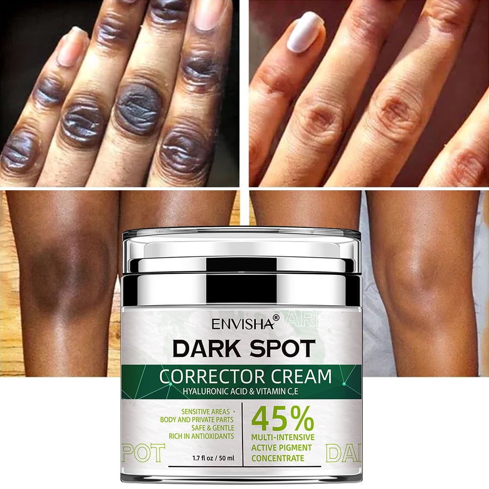 ENVISHA Face Skin Care Whitening Freckle Cream Remove Melasma Dark Spots Melanin Anti-Aging Lightening Shrink Pores Moisturizing