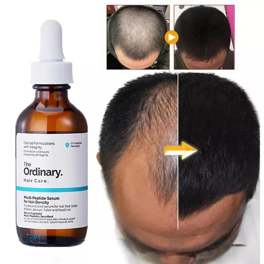 Hair Growth Serum 60ml Ordinary Original Authentic Hai Growth Essential Oils Care Essence Hair Loss Liquid Peptide Treatment