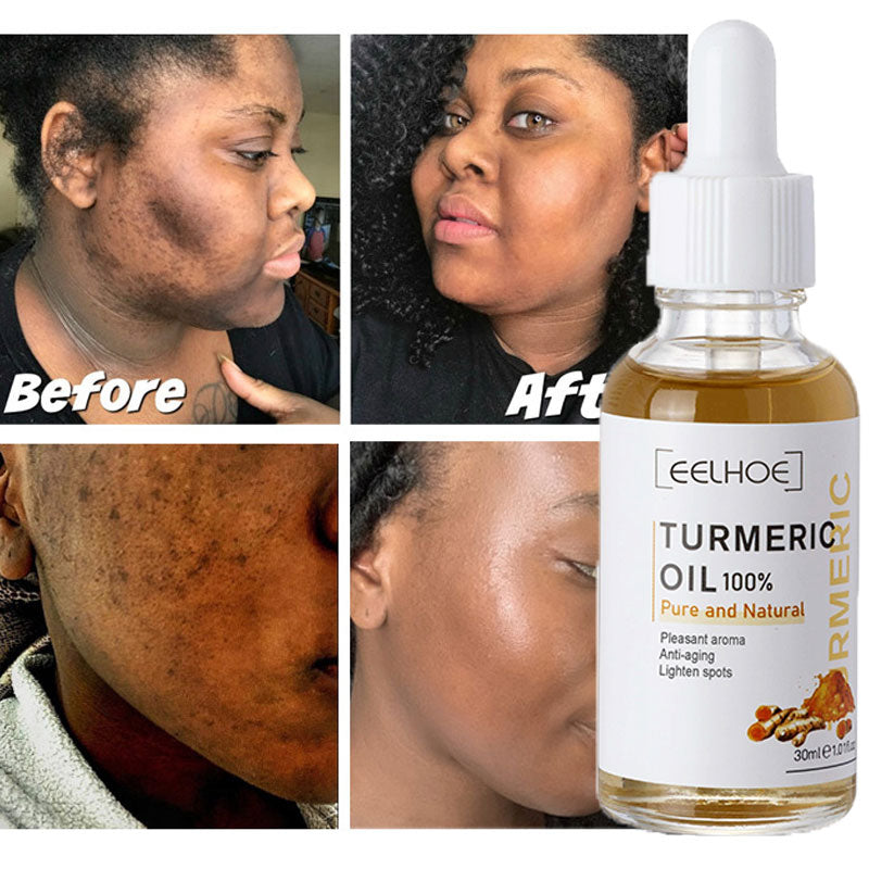 Turmeric Serum Whitening Freckle Dark Spots Organic Turmeric Oil Brighten Dark Skin Pigmentation Anti Aging Anti Wrinkle Essence