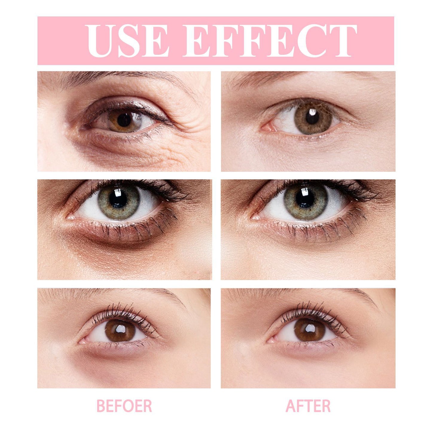 Magic Remove Wrinkles Eye Cream Lift Firming Removal Dark Circles Eye Bag Fade Fine Lines Brighten Moisturizing Beauty Skin Care