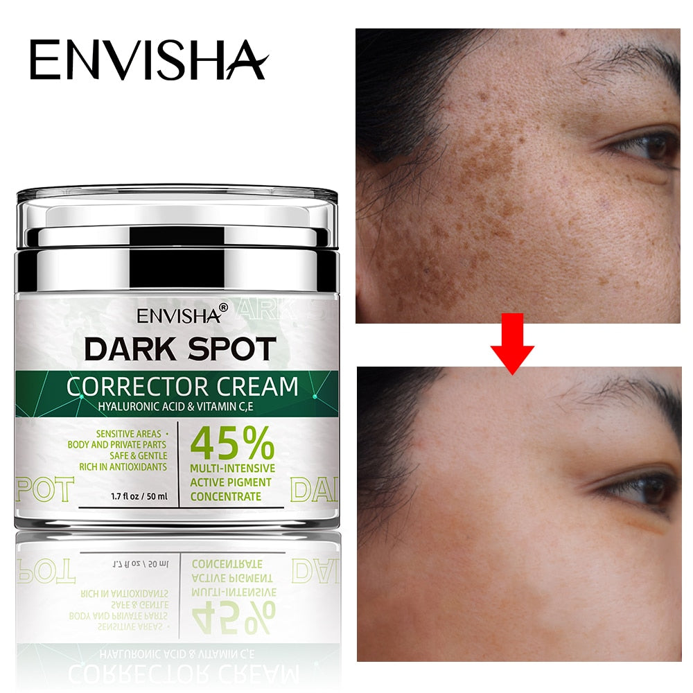 ENVISHA Face Skin Care Whitening Freckle Cream Remove Melasma Dark Spots Melanin Anti-Aging Lightening Shrink Pores Moisturizing
