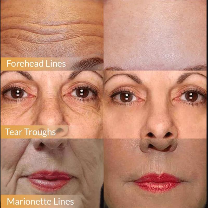 Instant Wrinkle Remover Face Serum Lifting Firming Anti-Aging Fade Fine Lines Repair Tighten Moisturizing Brightening Skin Care