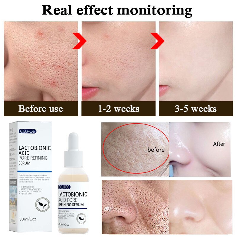 Effective Shrink Pores Facial Serum Smooth Pores Repair Essence Improve Blackheads Oil Control Moisturizing Nourishing Skin Care