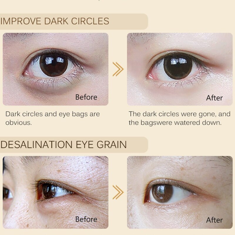 Wrinkle Removal Eye Serum Fade Fine Lines Eye Bags Remove Dark Circles Puffiness Roller Massager Moisturizing Essence Skin Care