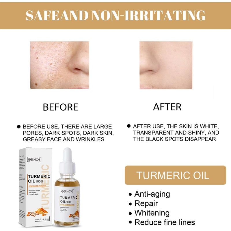 Turmeric Face Serum Lighten Spots Essential Oils Turmeric Oil Anti Aging Remove Dark Spots Pigmentation Corrector Skin Care 30ml