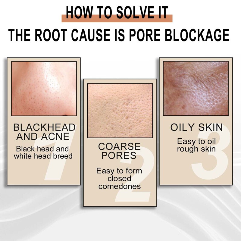 Lactobionic Acid Shrink Pores Face Serum Oil Control Removal Blackheads Acne Treatment Moisturizing Brighten Skin Care Products