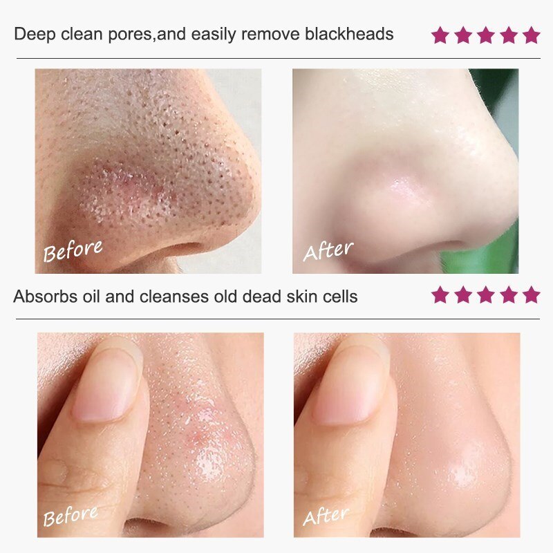 Effective Shrink Pores Facial Serum Smooth Pores Repair Essence Improve Blackheads Oil Control Moisturizing Nourishing Skin Care