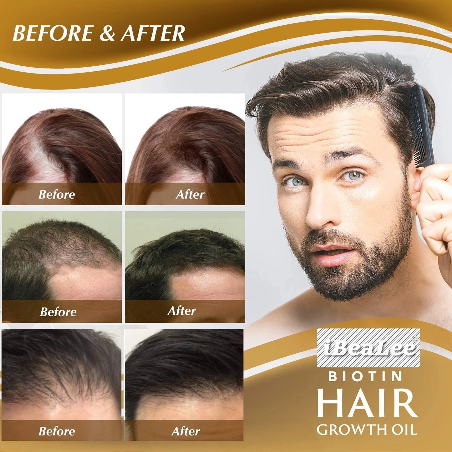 Fast Hair Growth Spray Products Anti Hair Loss Serum Prevent Baldness Treatment Scalp Dry Damaged Beard Hair Care Essential Oils