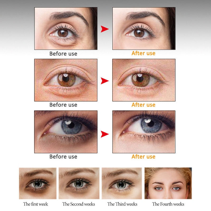 Peptide Anti-Wrinkle Eye Serum Collagen Massage  Cream Remove Dark Circles Eye Bags Puffiness Firming Skin Anti Aging Eye Care
