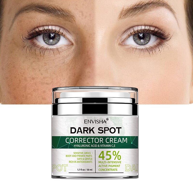 ENVISHA Face Skin Care Whitening Freckle Cream Remove Melasma Dark Spots Melanin Anti-Aging Lightening Shrink Pores Moisturizing