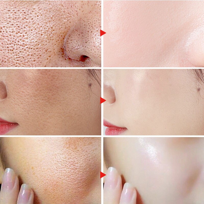 Whitening Moisturizing Retinol Face Serum Hyaluronic Acid Nourish Pores Repair Essence Korean Skin Care Products Cosmetics