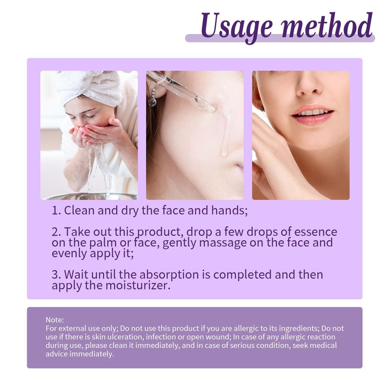 Vitamin C Whitening Freckle Face Serum Remove Melasma Acne Dark Spots Pigmentation Brighten Moisturizing Nourish Skin Care 30ml