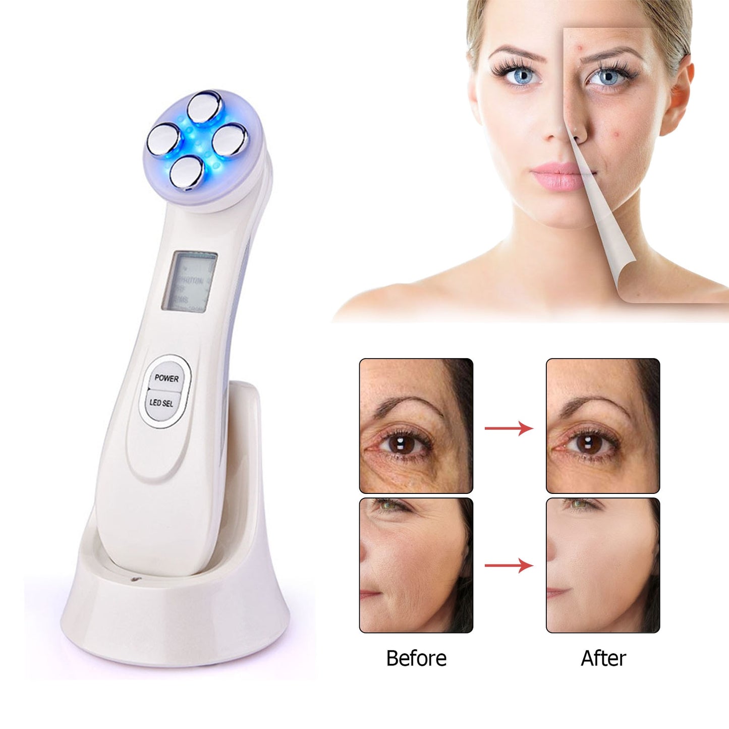EMS&amp;RF Facial Radiofrequency Lifting Machine Face Spa Massager 5 in 1 Beauty Devices LED Photon Skin Rejuvenation Mesotherapy