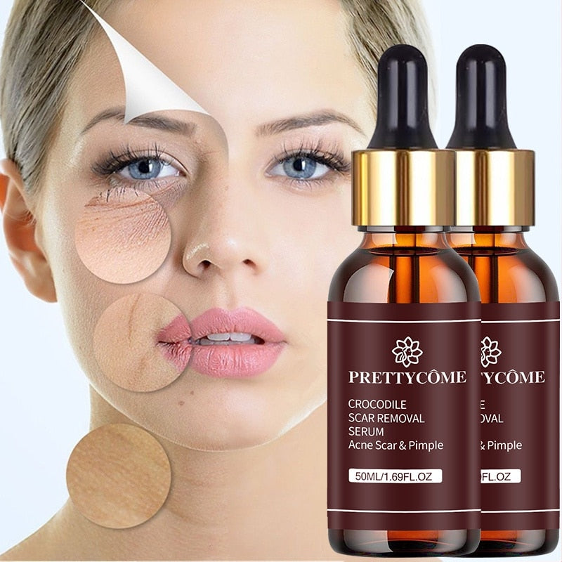 |200000581:200006902#10ml|200000581:200008193#20ml|200000581:201442859#30ml|200000581:200008194#50ml