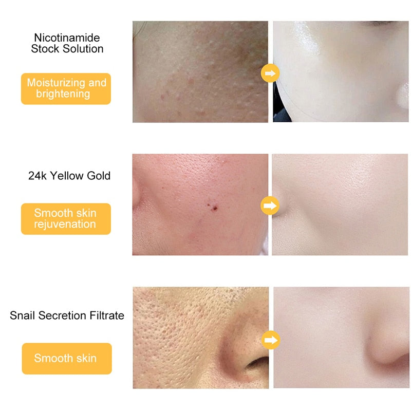 24K Gold Face Serum Hyaluronic Acid Moisturizing Essence Brightening Skin Tone Shrink Pores Anti Wrinkle Whitening Skin Care 30g