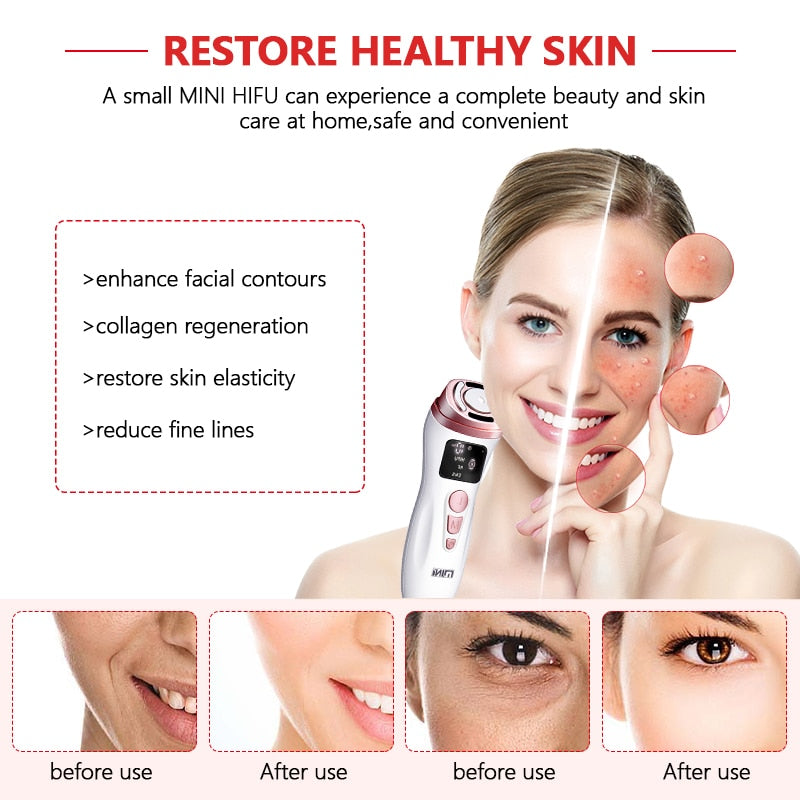 New Mini HIFU RF Ultrasonic Facial Machine EMS Micro Current Lifting Firming Lifting Wrinkle Skin Care Machine Massager