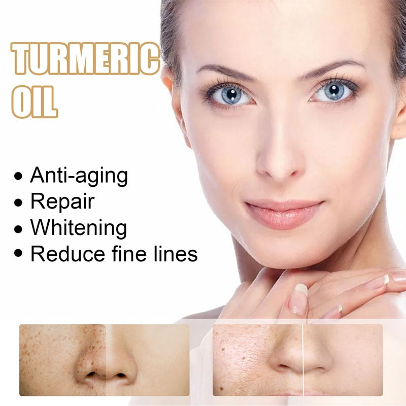 Turmeric Face Serum Lighten Spots Essential Oils Turmeric Oil Anti Aging Remove Dark Spots Pigmentation Corrector Skin Care 30ml