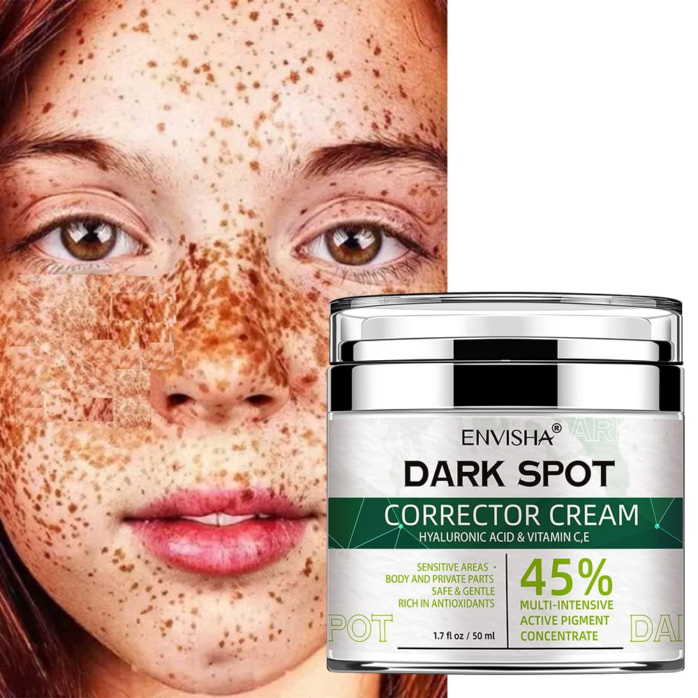 ENVISHA Face Skin Care Whitening Freckle Cream Remove Melasma Dark Spots Melanin Anti-Aging Lightening Shrink Pores Moisturizing