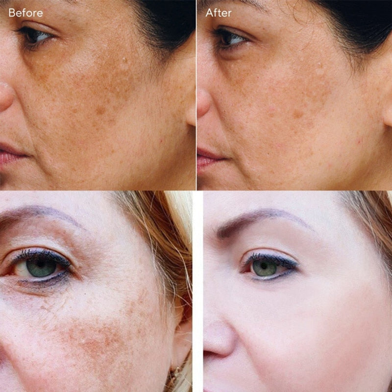 Turmeric Serum Whitening Freckle Dark Spots Organic Turmeric Oil Brighten Dark Skin Pigmentation Anti Aging Anti Wrinkle Essence