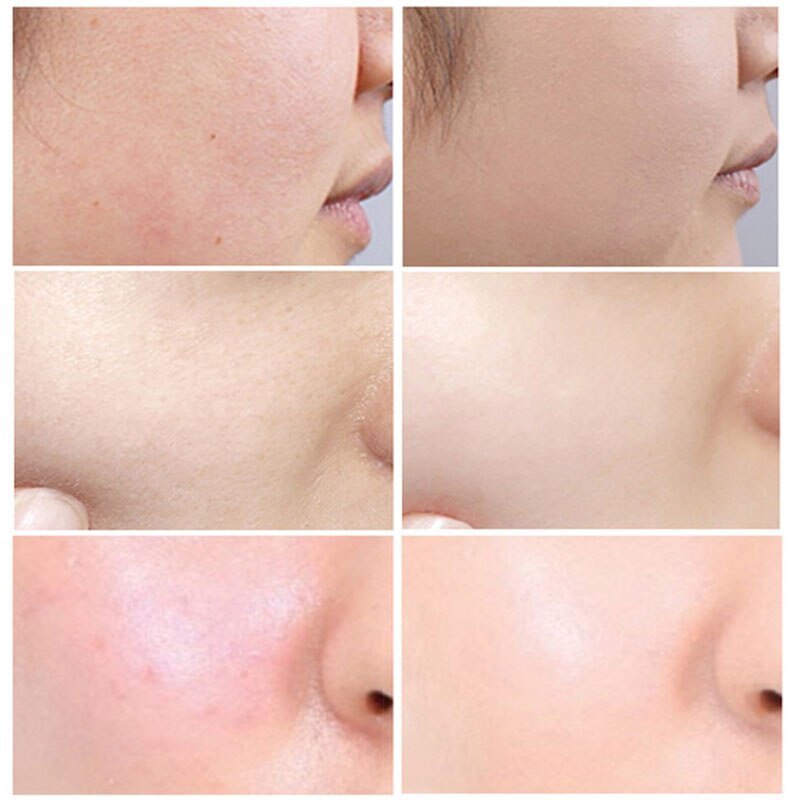 Lactobionic Acid Shrink Pores Face Serum Oil Control Removal Blackheads Acne Treatment Moisturizing Brighten Skin Care Products