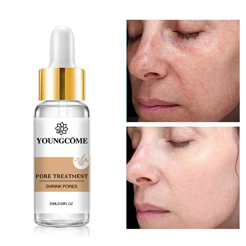 20ML Japan Sakura Essence Anti Aging Hyaluronic Acid Pure 24K Gold Whitening Vitamin C Anti Wrinkle Face Serum Care Skin