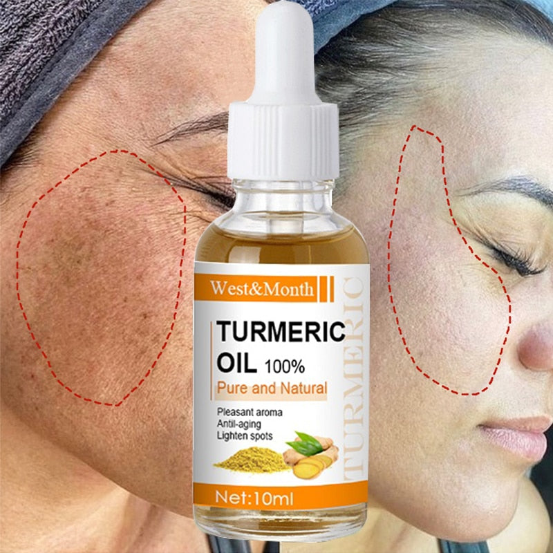 Turmeric Serum Whitening Freckle Dark Spots Organic Turmeric Oil Brighten Dark Skin Pigmentation Anti Aging Anti Wrinkle Essence